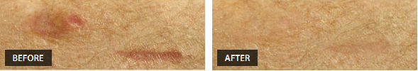 Accident Scars